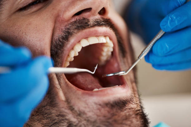 Best After-Hours Dental Care in Pearsall, TX