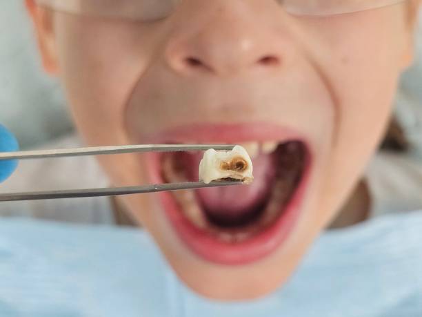 Best Emergency Dental Care for Sports Injuries in Pearsall, TX